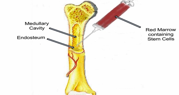 bone-marrow